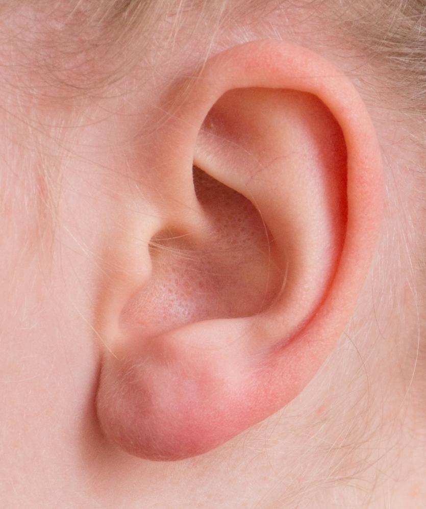 Exame de audiometria é fundamental para a detecção precoce da perda auditiva