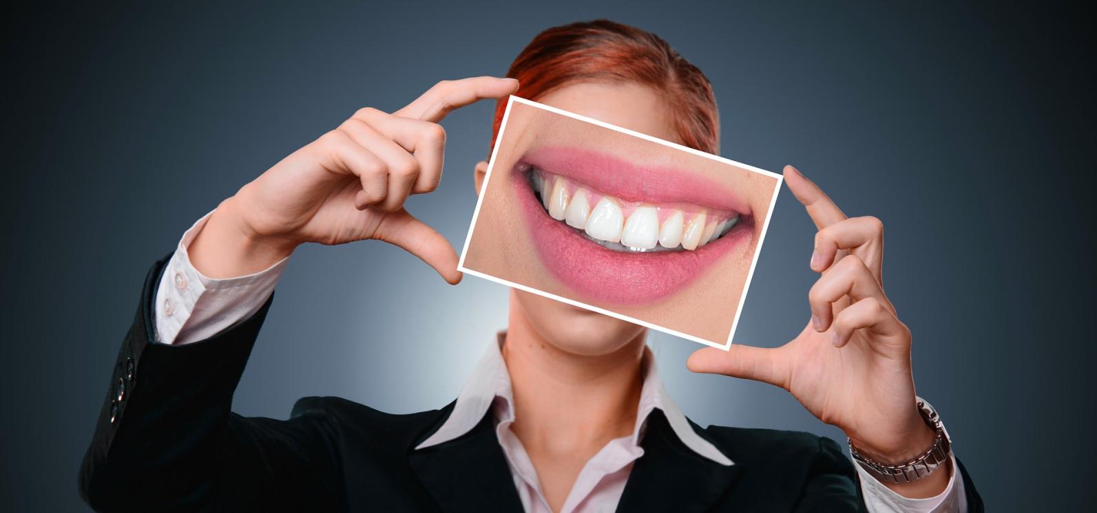 Vilões do clareamento dental: o que deve ser evitado durante o tratamento