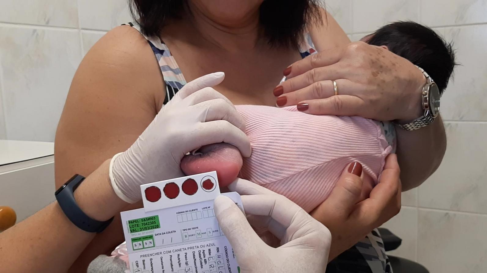 APAE de Limeira retoma Testes do Pezinho