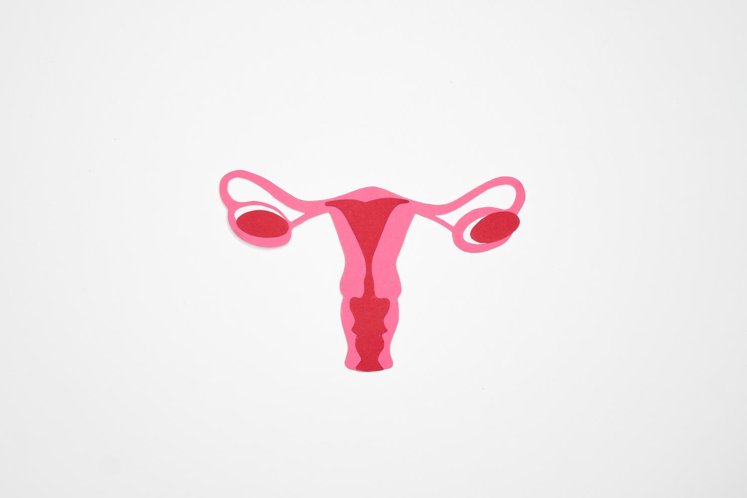Endometriose: atenção aos sintomas