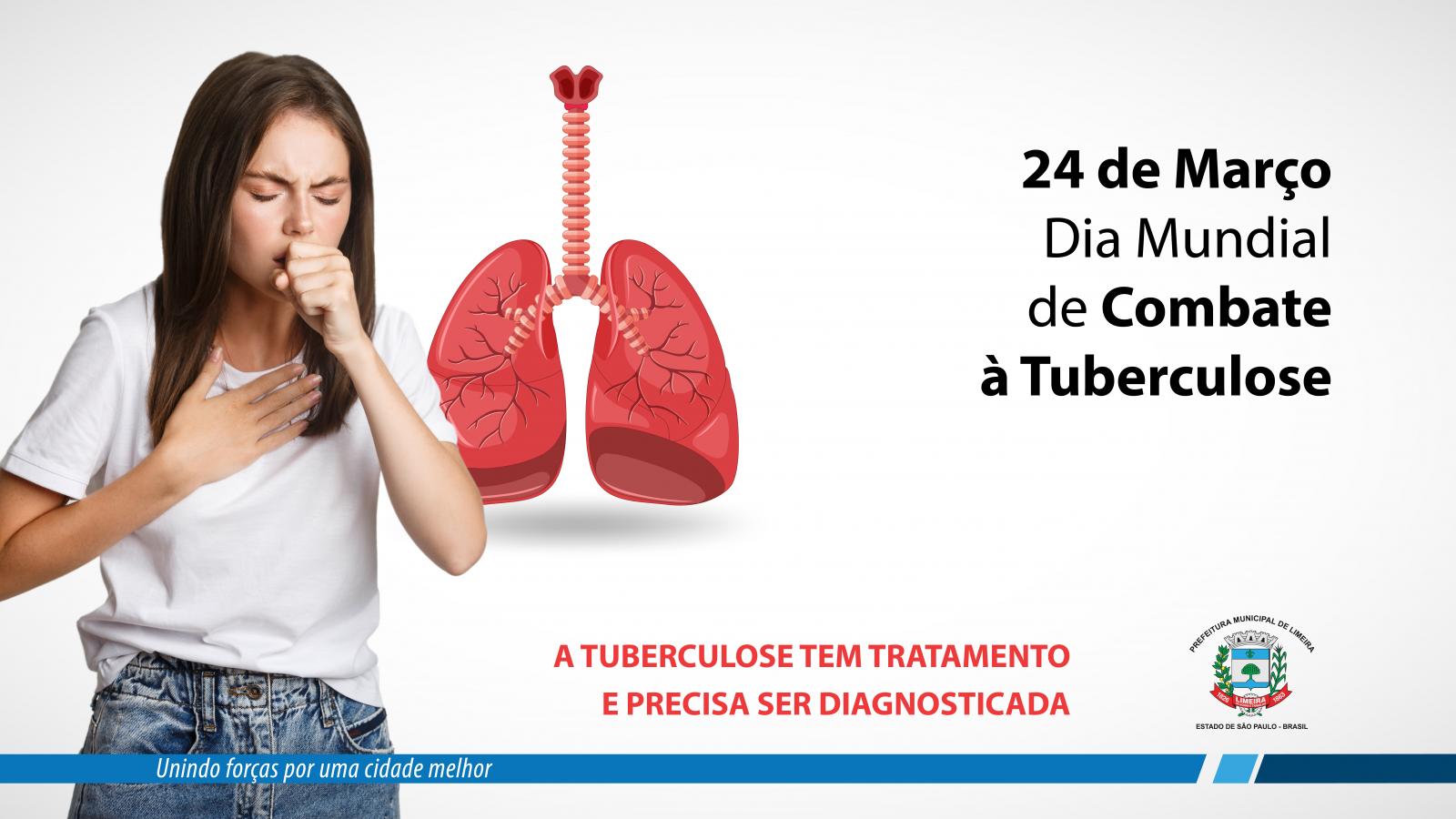 Campanha para diagnóstico de tuberculose segue até a próxima semana em Limeira