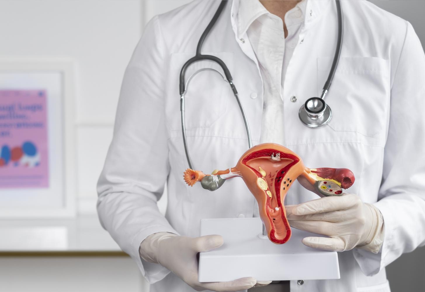 Diagnóstico de endometriose ainda é um desafio para mulheres